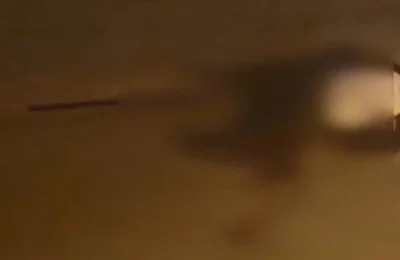 Sokak ortasında vuruldu, ağır yaralandı