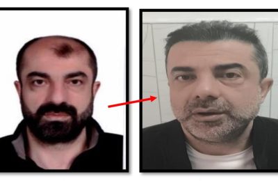 Estetikle yüzünü değiştiren cinayet zanlısı yakalandı